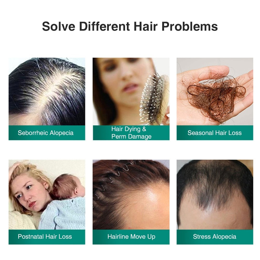 Hair Growth Intensive Spray for Men and Women