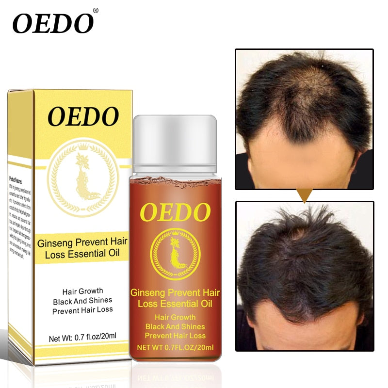 Ginseng Hair loss treatment OEDO - HaiRegrow