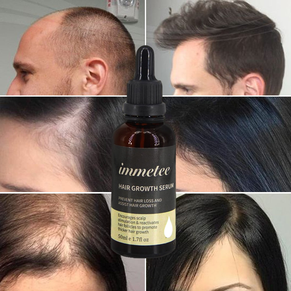 Reagain Ultimate Anti Hair Loss Treatment - HaiRegrow
