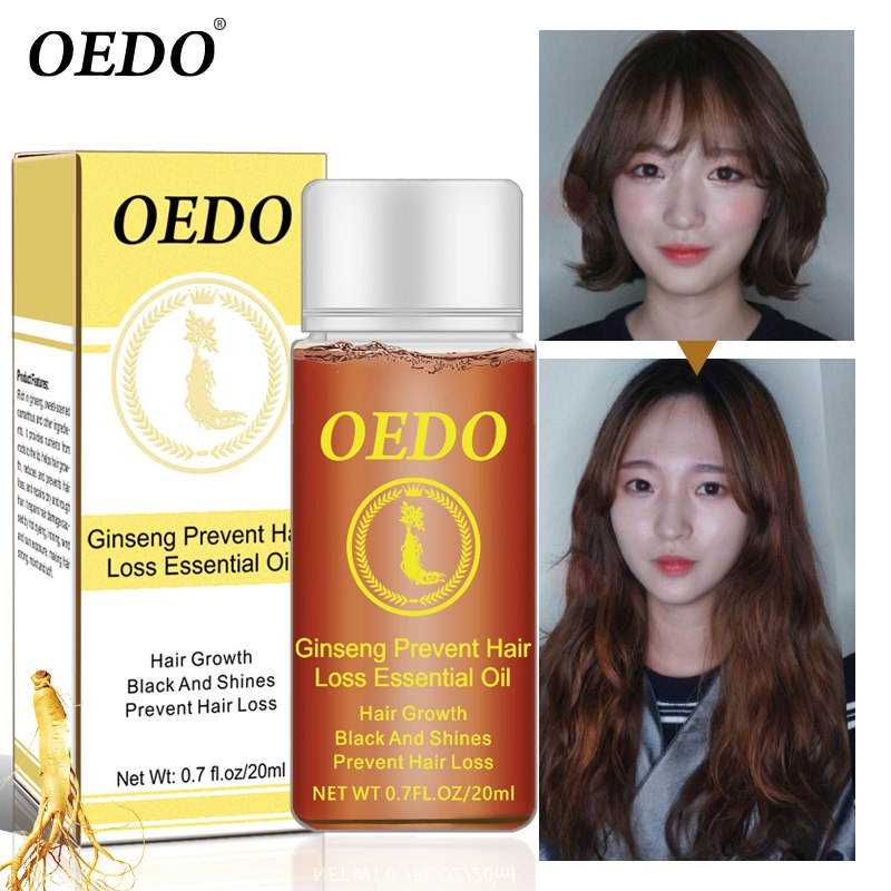 Ginseng Hair loss treatment OEDO - HaiRegrow