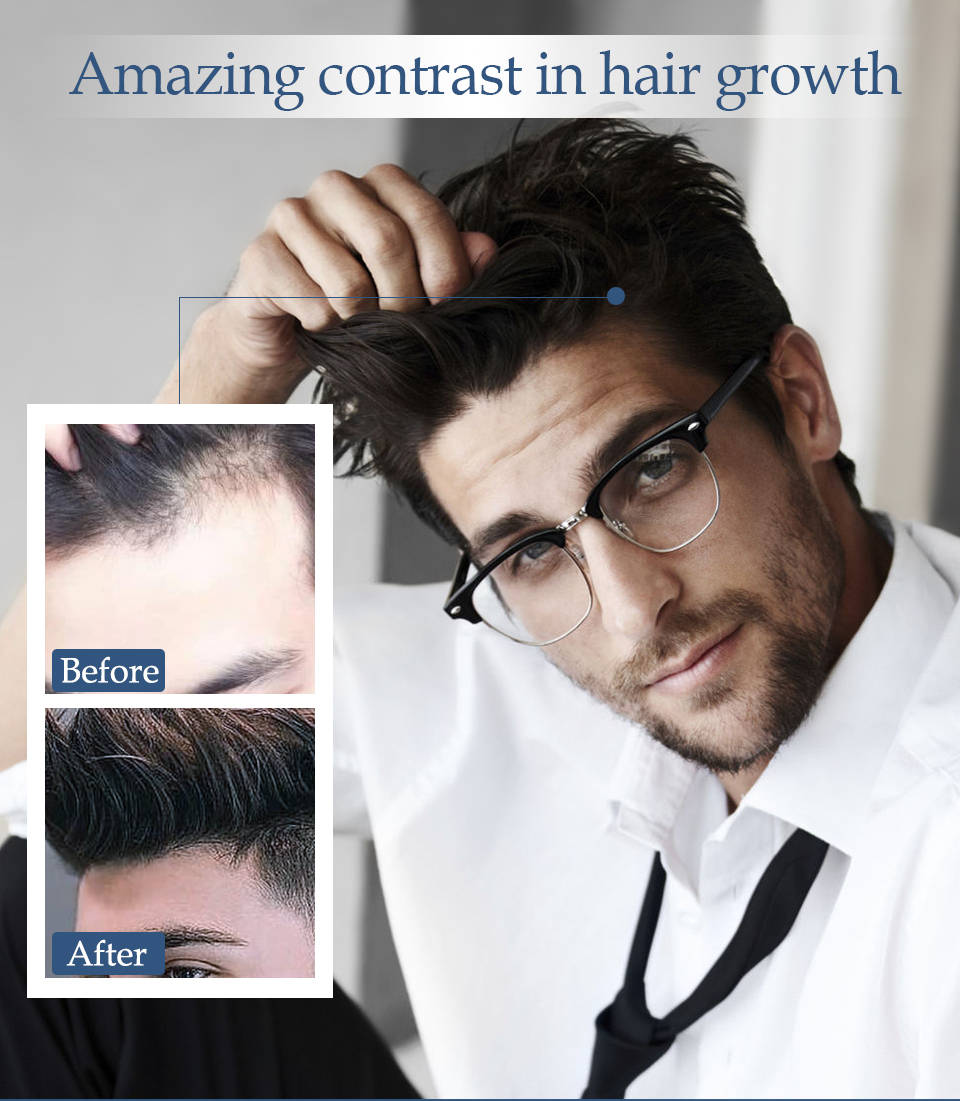 Reagain Ultimate Anti Hair Loss Treatment - HaiRegrow