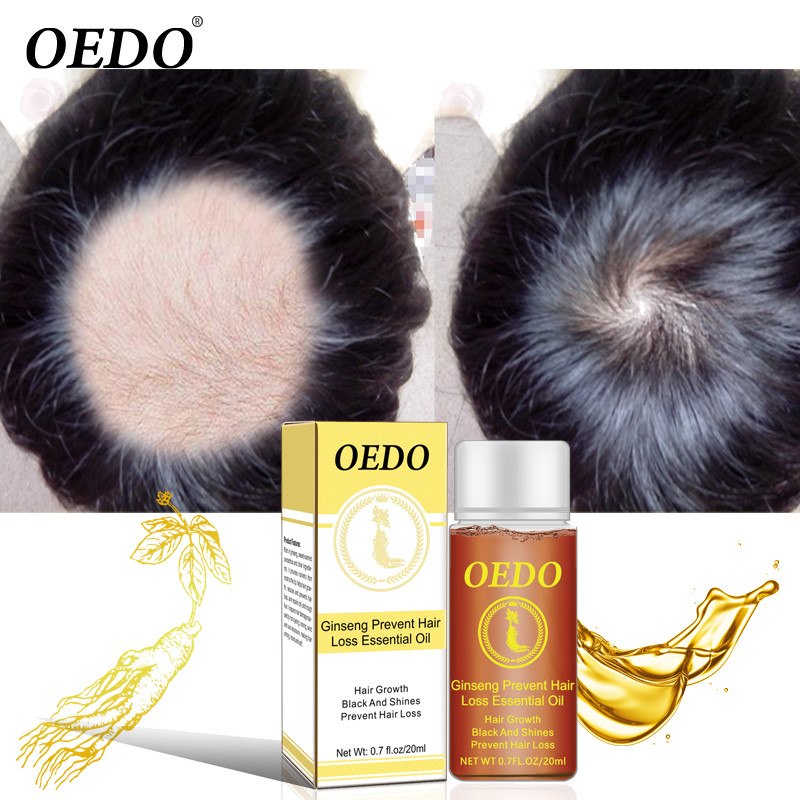 Ginseng Hair loss treatment OEDO - HaiRegrow