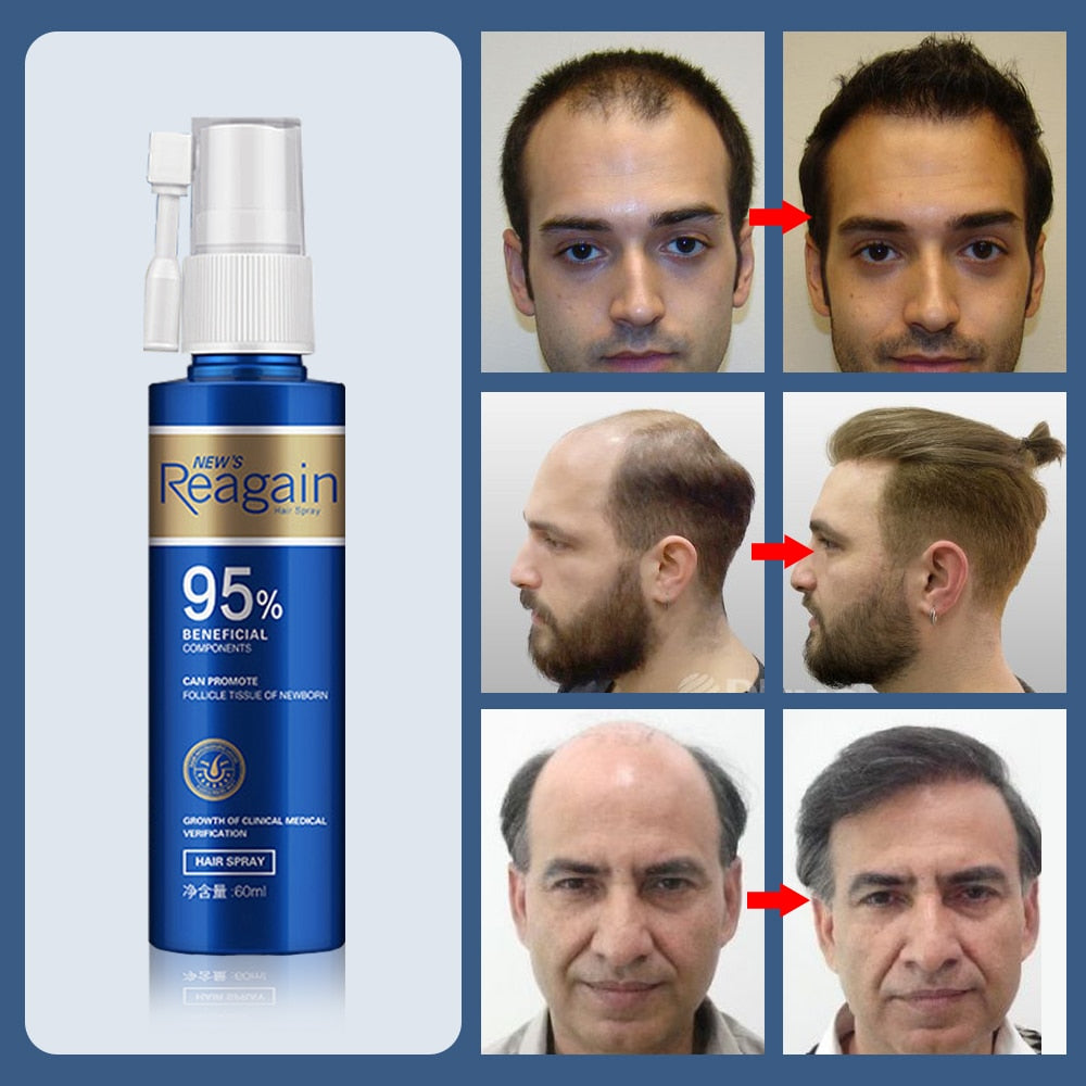 Reagain Ultimate Anti Hair Loss Treatment - HaiRegrow