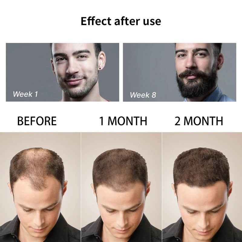 The Beard Growth Kit