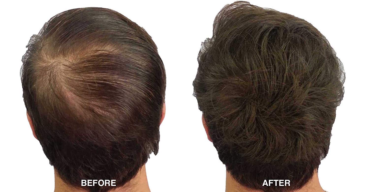 Keratin Hair Building Fibers for Women & Men - HaiRegrow