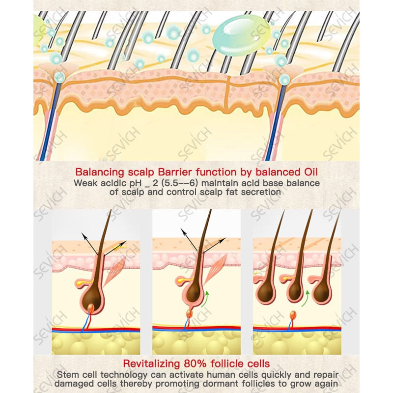 30ML Hair Regrowth Essence Intensive Spray