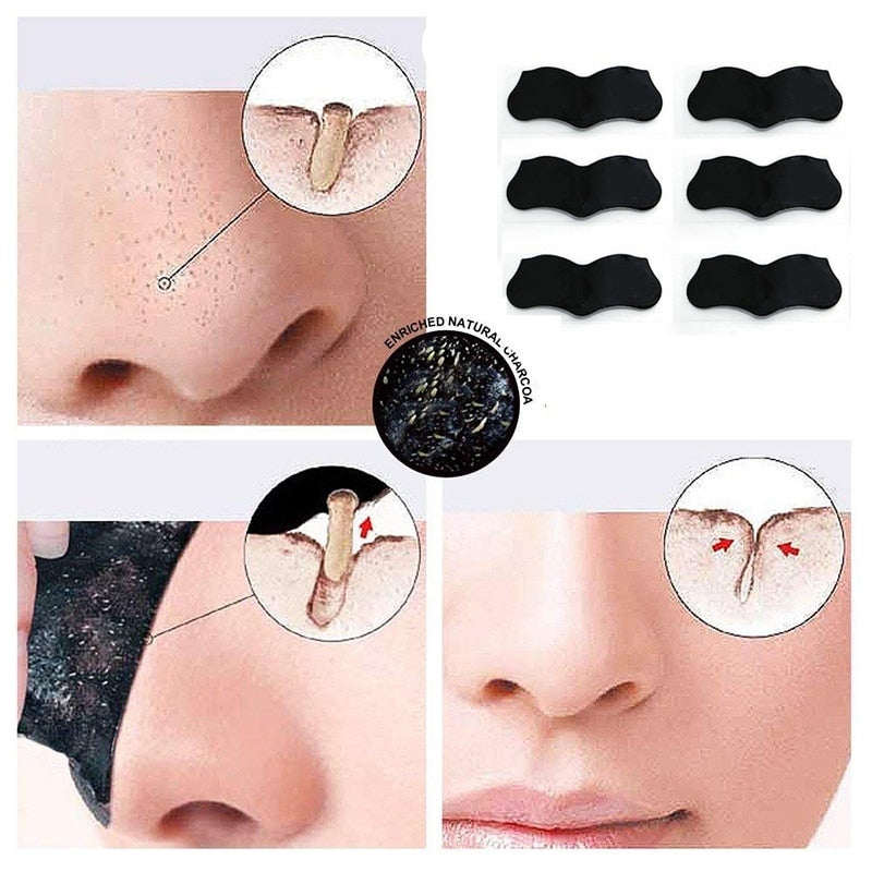 Charcoal Blackhead Remover