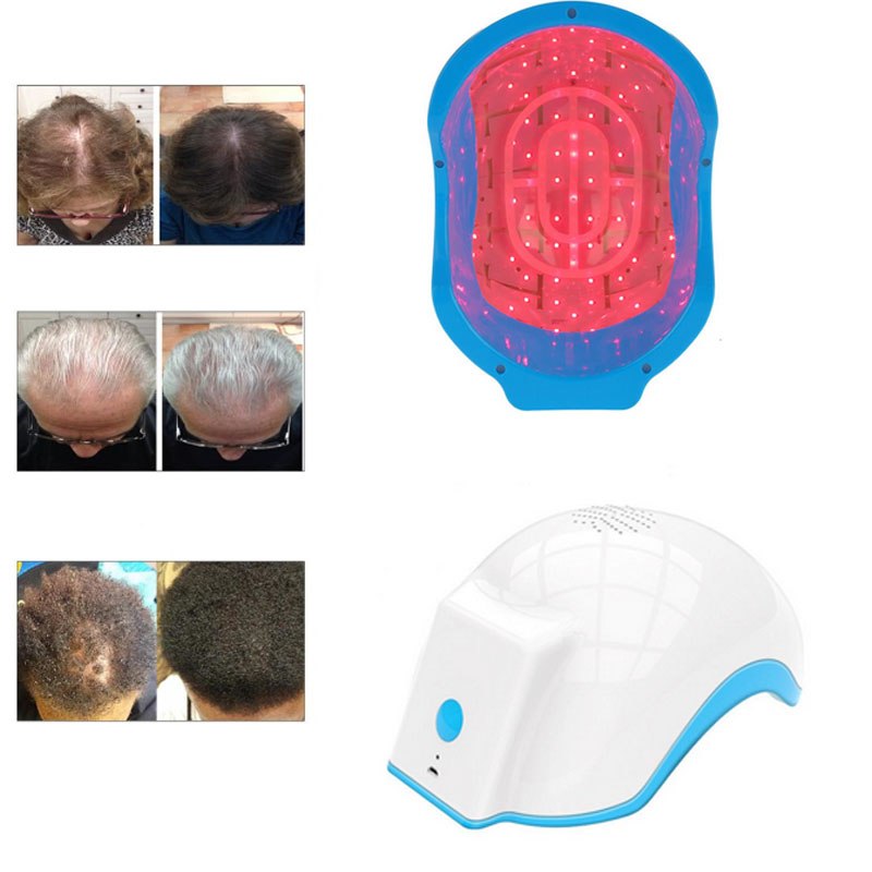 Laser Helmet for Hair Growth Therapy - HaiRegrow