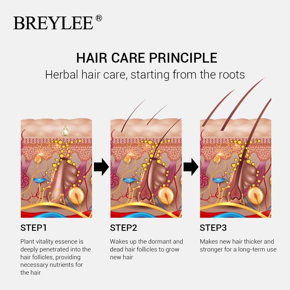 Hair Growth Oil for Alopecia BREYLEE - HaiRegrow