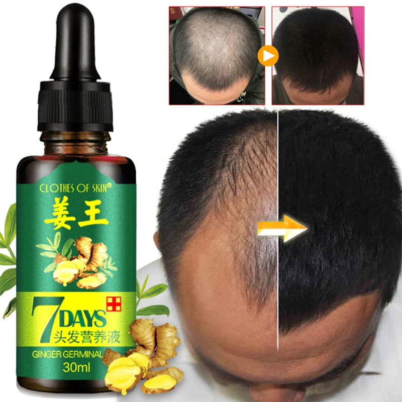 Ginger Germinal Oil 7 Days Hair Regrowth