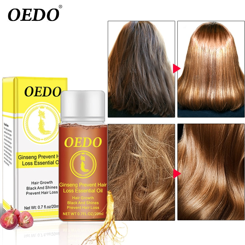 Ginseng Hair loss treatment OEDO - HaiRegrow