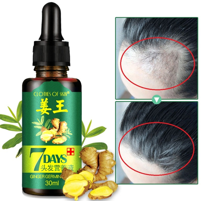 Ginger Germinal Oil 7 Days Hair Regrowth