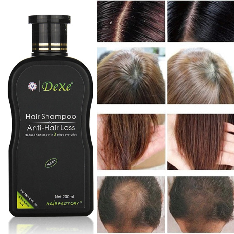 Dexe Professional Shampoo for Hair Loss for Men & Women - HaiRegrow