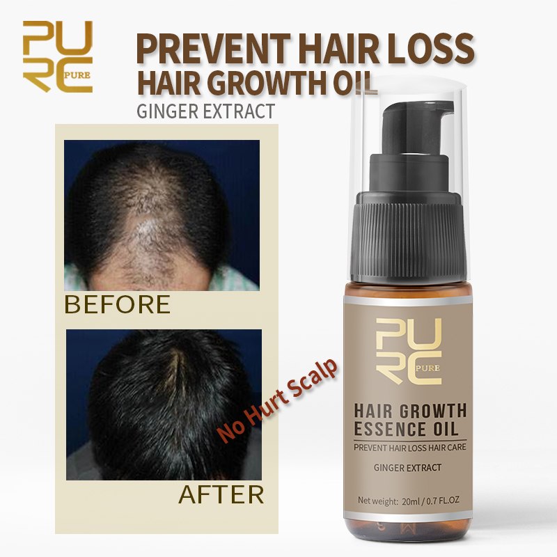 Hair Growth Oil to Prevent Hair Loss PURC - HaiRegrow