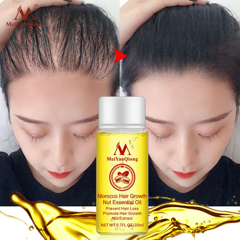 New Arrival Ginger Oil Hair Growth Serum - HaiRegrow