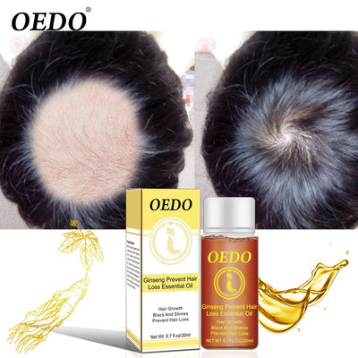 Ginseng Hair loss treatment OEDO - HaiRegrow