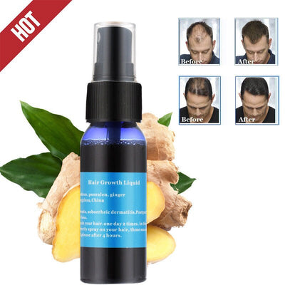 Okeny's brand yuda pilatory stop hair loss fast hair growth products for men and woman hair growth essence grow restorationTSLM1