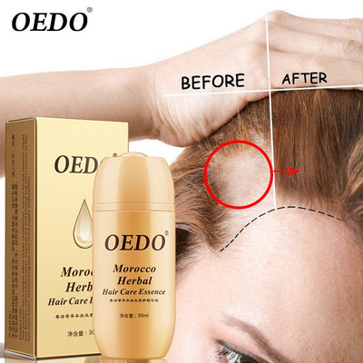 Hair Loss Treatment Shampoo with Ginseng OEDO - HaiRegrow