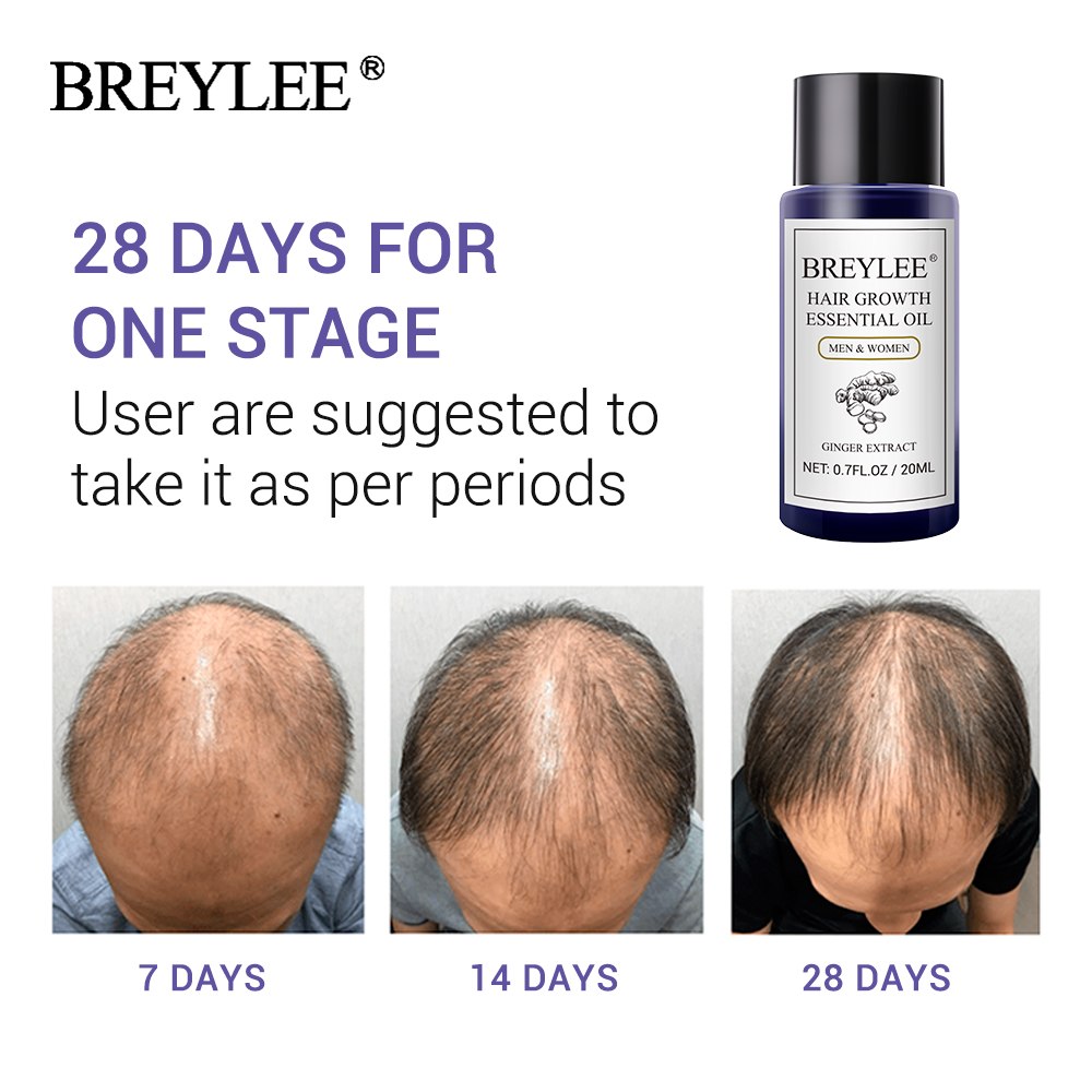 Hair Growth Oil for Alopecia BREYLEE - HaiRegrow