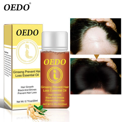 Ginseng Hair loss treatment OEDO - HaiRegrow