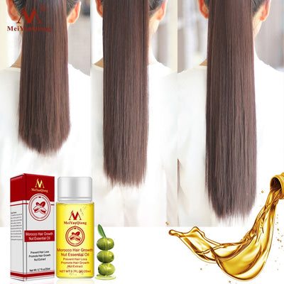 New Arrival Ginger Oil Hair Growth Serum - HaiRegrow