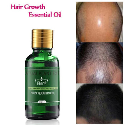 Hair Growth Essence Original Authentic 100% - HaiRegrow
