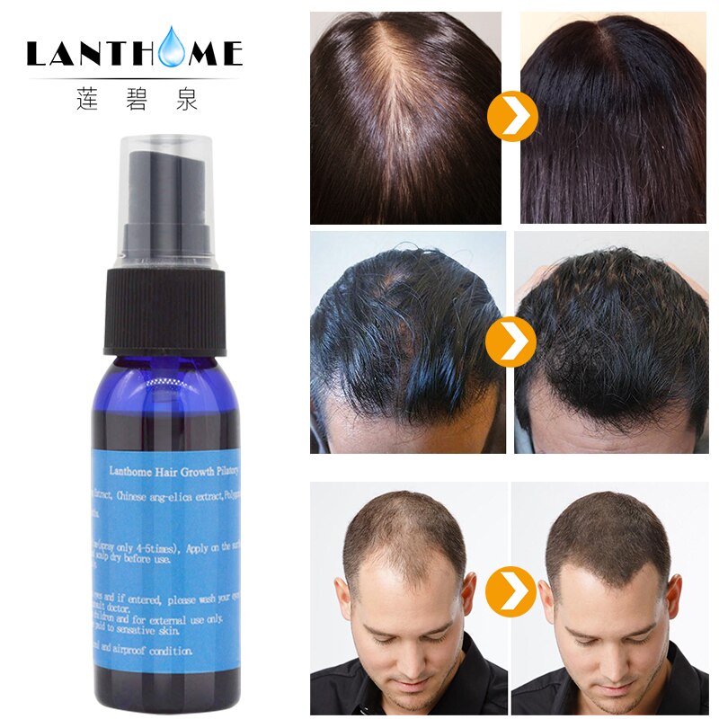 Hair Growth Spray Lanthome
