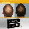 KERASTIM PRO ANTI HAIR LOSS SCALP TREATMENT GROWTH 15x5ml